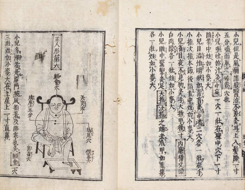 View full screen - View 1 of Lot 5. Anonymous | The Newly Published Yellow Emperor's Book on Moxibustion (Shinkan kotei meido kyukei) | Edo period, 17th century.