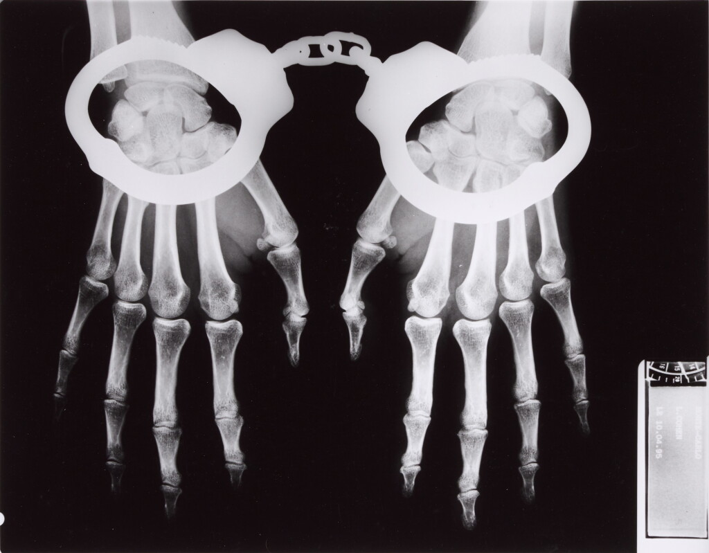 View full screen - View 1 of Lot 6. 'X-Ray with Handcuffs', French Vogue, Paris, 1994.