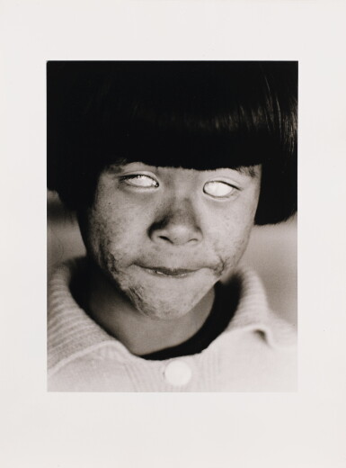 View full screen - View 1 of Lot 23. CHRISTER STRÖMHOLM | THE BLIND GIRL, HIROSHIMA, 1963.